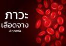 Anemia เลือดจาง โลหิตจาง