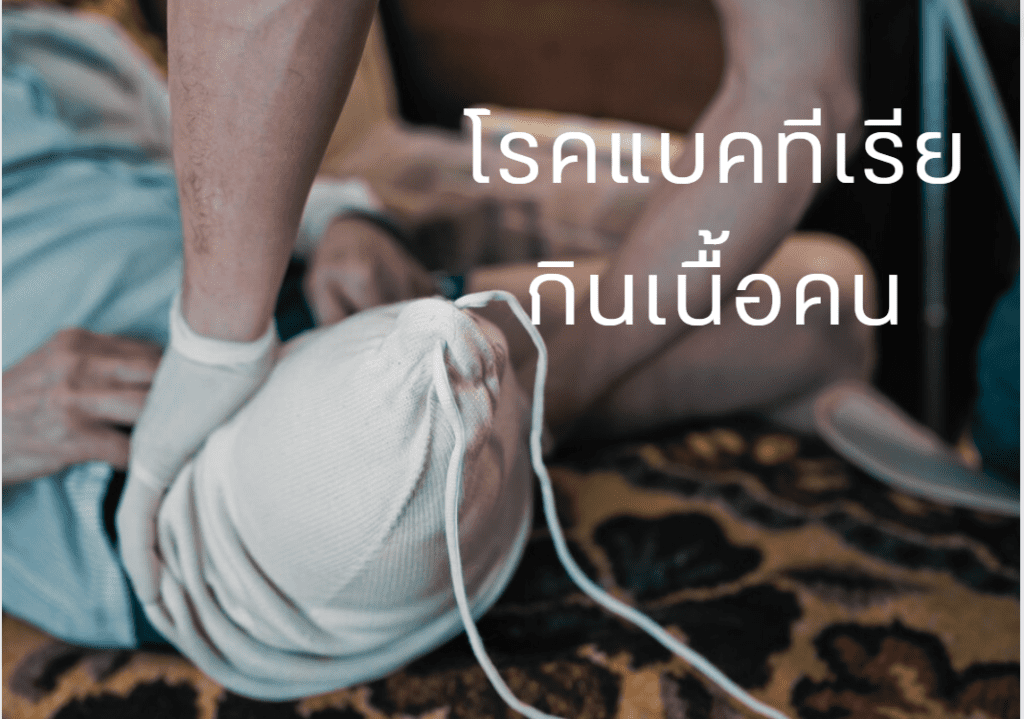 โรคแบคทีเรียกินเนื้อคน โรคเนื้อเน่า